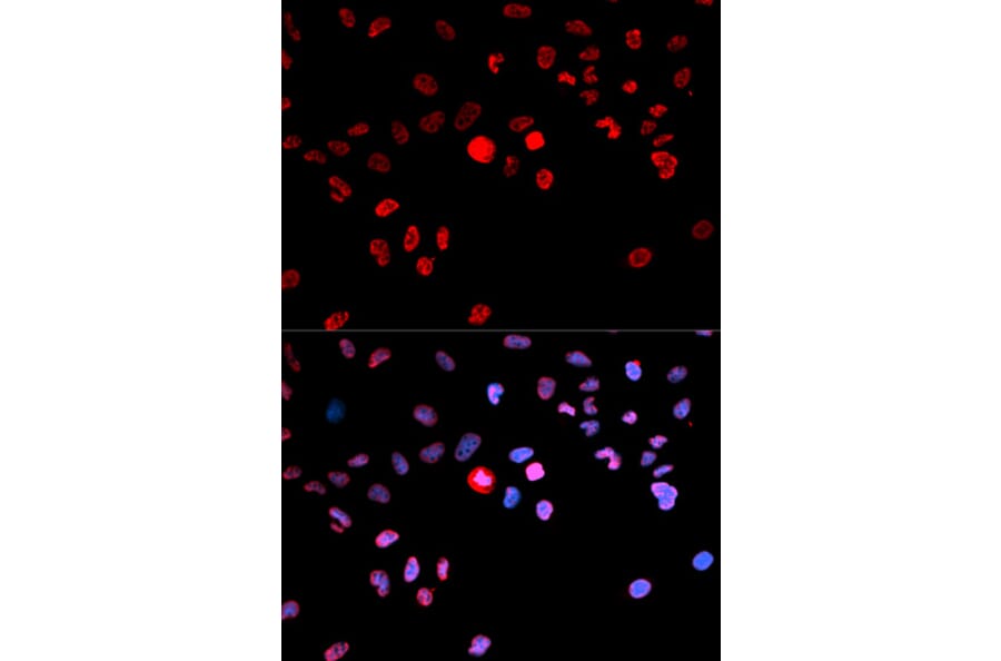 Anti-CREB (phospho-S133) Antibody from Bioworld Technology (BS6345) - Antibodies.com