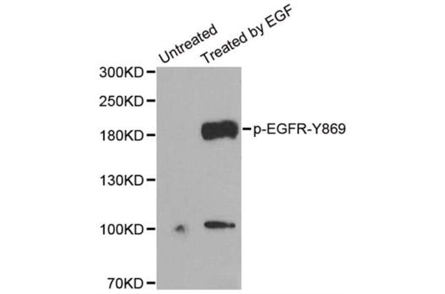 Anti-EGFR (phospho-Y845) Antibody from Bioworld Technology (BS6349) - Antibodies.com