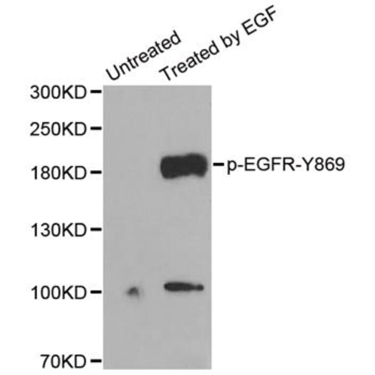 Anti-EGFR (phospho-Y845) Antibody from Bioworld Technology (BS6349) - Antibodies.com