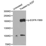 Anti-EGFR (phospho-Y845) Antibody from Bioworld Technology (BS6349) - Antibodies.com