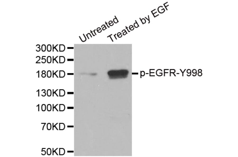 Anti-EGFR (phospho-Y992) Antibody from Bioworld Technology (BS6352) - Antibodies.com