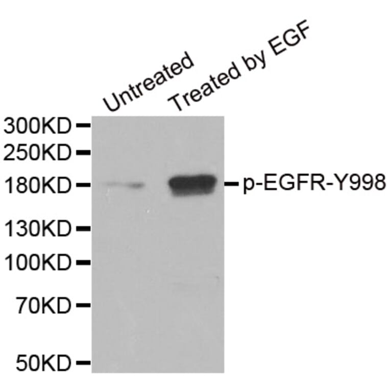 Anti-EGFR (phospho-Y992) Antibody from Bioworld Technology (BS6352) - Antibodies.com
