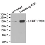 Anti-EGFR (phospho-Y992) Antibody from Bioworld Technology (BS6352) - Antibodies.com