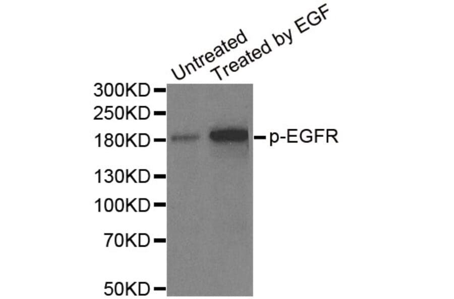 Anti-EGFR (phospho-Y1148) Antibody from Bioworld Technology (BS6354) - Antibodies.com
