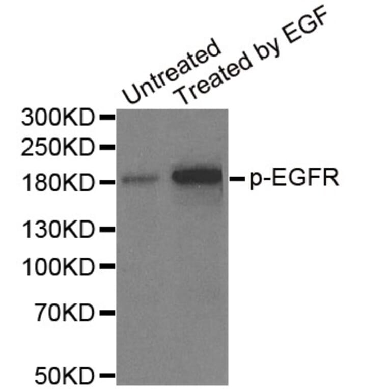 Anti-EGFR (phospho-Y1148) Antibody from Bioworld Technology (BS6354) - Antibodies.com