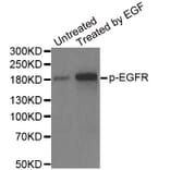 Anti-EGFR (phospho-Y1148) Antibody from Bioworld Technology (BS6354) - Antibodies.com