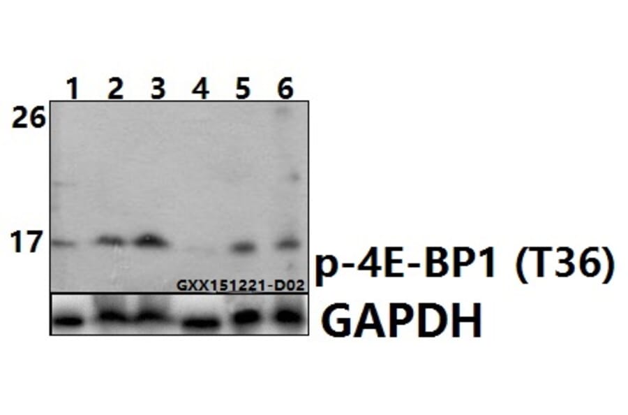 Anti-4E-BP1 (phospho-T36) Antibody from Bioworld Technology (BS6356) - Antibodies.com