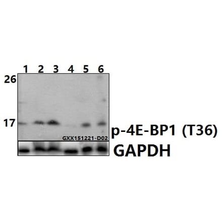 Anti-4E-BP1 (phospho-T36) Antibody from Bioworld Technology (BS6356) - Antibodies.com