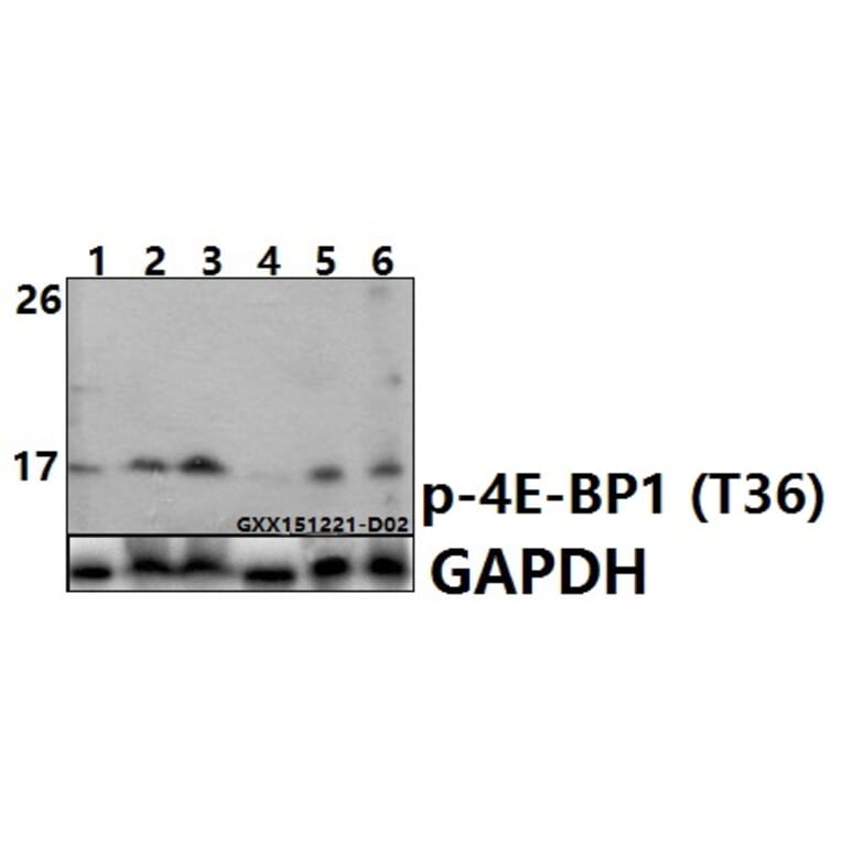Anti-4E-BP1 (phospho-T36) Antibody from Bioworld Technology (BS6356) - Antibodies.com