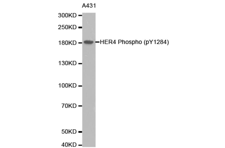Anti-ErbB-4 / HER4 Antibody from Bioworld Technology (BS6360) - Antibodies.com
