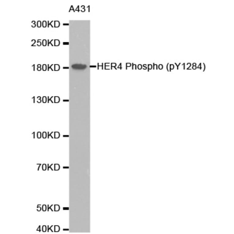 Anti-ErbB-4 / HER4 Antibody from Bioworld Technology (BS6360) - Antibodies.com