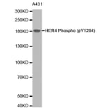 Anti-ErbB-4 / HER4 Antibody from Bioworld Technology (BS6360) - Antibodies.com