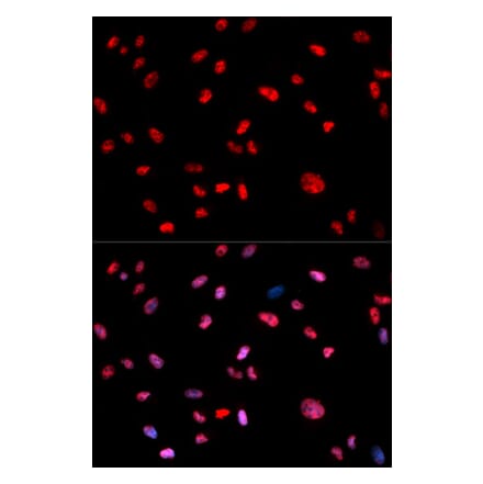 Anti-c-Jun (phospho-T239) Antibody from Bioworld Technology (BS6375) - Antibodies.com