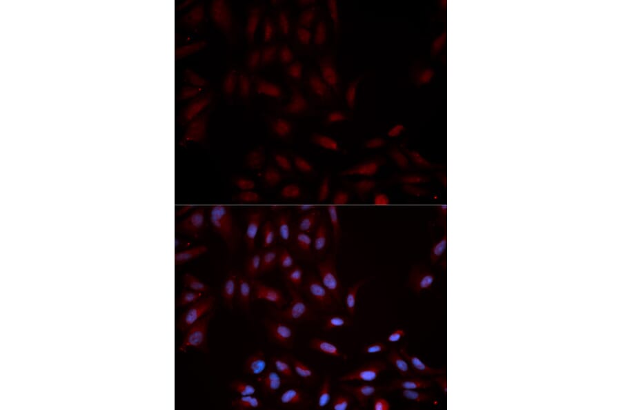 Anti-p38/MAPK14 (phospho-Y322) Antibody from Bioworld Technology (BS6381) - Antibodies.com