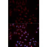 Anti-p38/MAPK14 (phospho-Y322) Antibody from Bioworld Technology (BS6381) - Antibodies.com