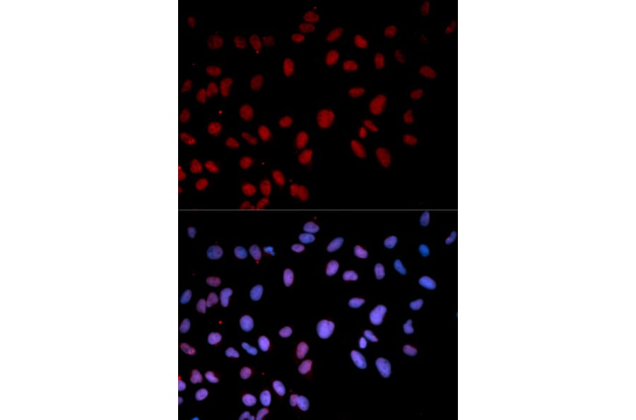 Anti-p38/MAPK14 (phospho-T180) Antibody from Bioworld Technology (BS6382) - Antibodies.com