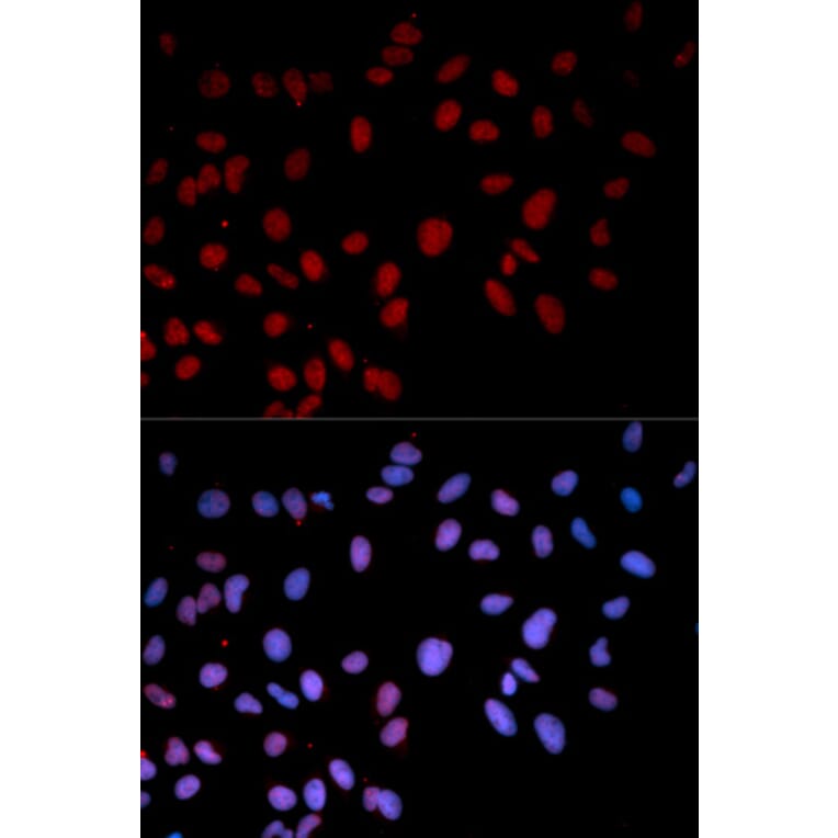 Anti-p38/MAPK14 (phospho-T180) Antibody from Bioworld Technology (BS6382) - Antibodies.com