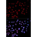 Anti-p38/MAPK14 (phospho-T180) Antibody from Bioworld Technology (BS6382) - Antibodies.com