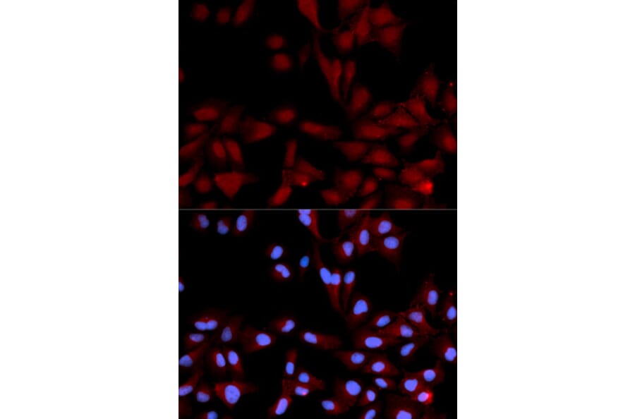 Anti-p38/MAPK14 (phospho-Y182) Antibody from Bioworld Technology (BS6383) - Antibodies.com