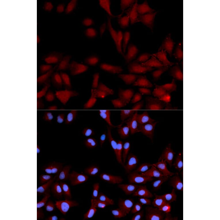 Anti-p38/MAPK14 (phospho-Y182) Antibody from Bioworld Technology (BS6383) - Antibodies.com