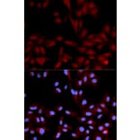 Anti-p38/MAPK14 (phospho-Y182) Antibody from Bioworld Technology (BS6383) - Antibodies.com