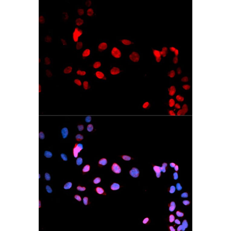 Anti-MAX (phospho-S11) Antibody from Bioworld Technology (BS6398) - Antibodies.com