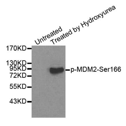Anti-MDM2 (phospho-S166) Antibody from Bioworld Technology (BS6399) - Antibodies.com