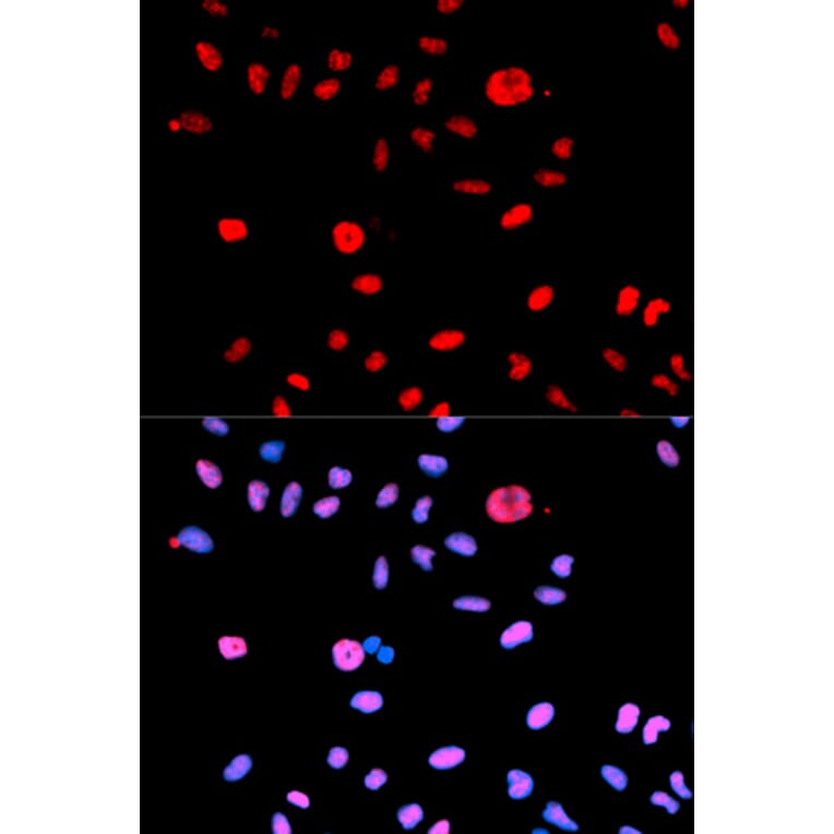 Anti-MDM2 (phospho-S166) Antibody from Bioworld Technology (BS6399) - Antibodies.com