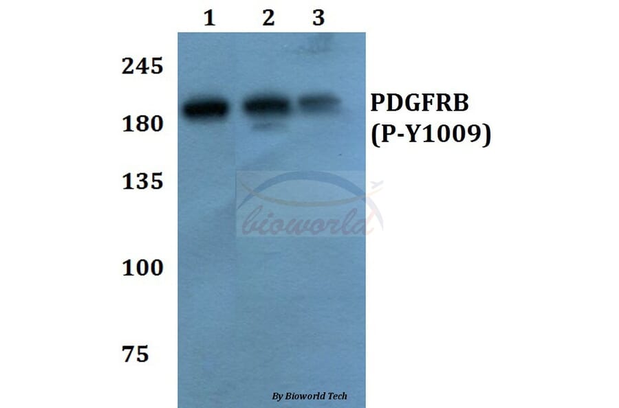 Anti-PDGFR-β (phospho-Y1009) Antibody from Bioworld Technology (BS64002) - Antibodies.com