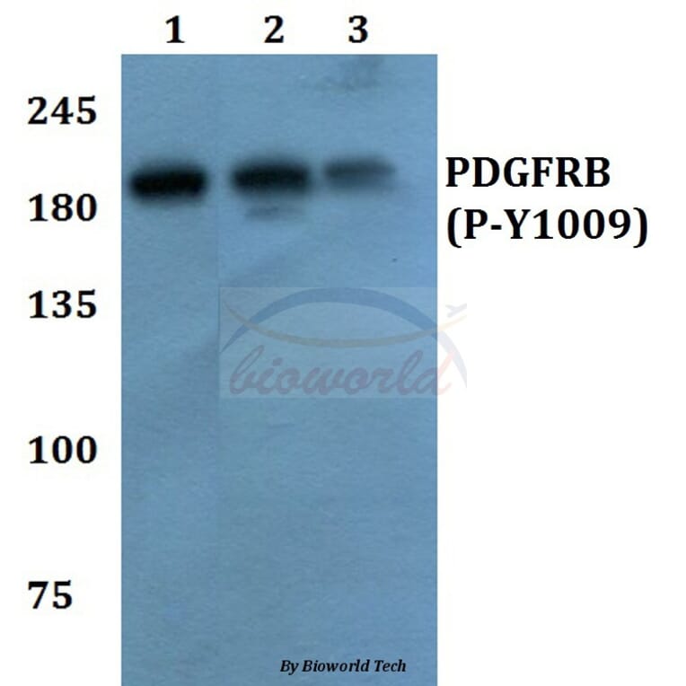 Anti-PDGFR-β (phospho-Y1009) Antibody from Bioworld Technology (BS64002) - Antibodies.com