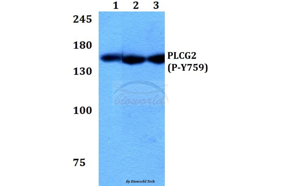 Anti-PLC γ2 (phospho-Y759) Antibody from Bioworld Technology (BS64003) - Antibodies.com