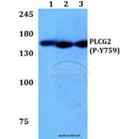 Anti-PLC γ2 (phospho-Y759) Antibody from Bioworld Technology (BS64003) - Antibodies.com