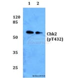 Anti-Chk2 (phospho-T432) Antibody from Bioworld Technology (BS64006) - Antibodies.com