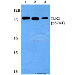 Anti-TLK1 (phospho-S743) Antibody from Bioworld Technology (BS64008) - Antibodies.com