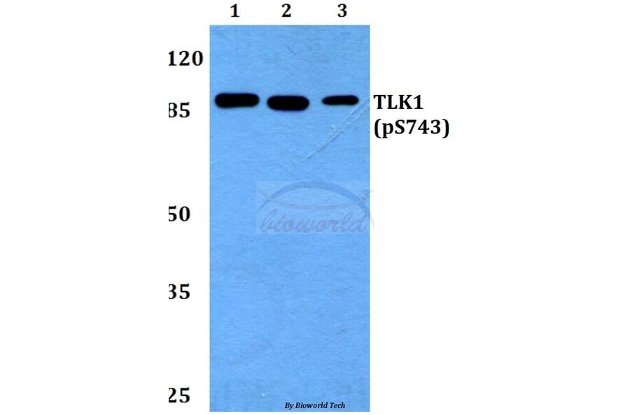 Anti-TLK1 (phospho-S743) Antibody from Bioworld Technology (BS64008) - Antibodies.com