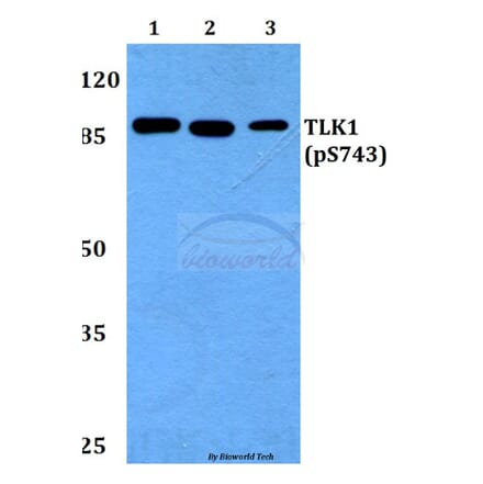 Anti-TLK1 (phospho-S743) Antibody from Bioworld Technology (BS64008) - Antibodies.com