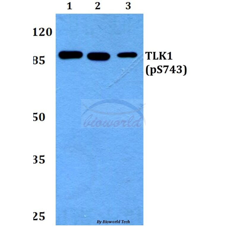 Anti-TLK1 (phospho-S743) Antibody from Bioworld Technology (BS64008) - Antibodies.com