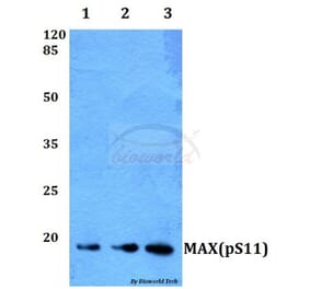 Anti-MAX (phospho-S11) Antibody from Bioworld Technology (BS64009) - Antibodies.com