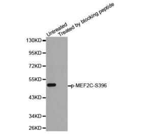 Anti-MEF2C (phospho-S396) Antibody from Bioworld Technology (BS6401) - Antibodies.com