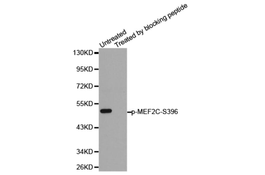Anti-MEF2C (phospho-S396) Antibody from Bioworld Technology (BS6401) - Antibodies.com
