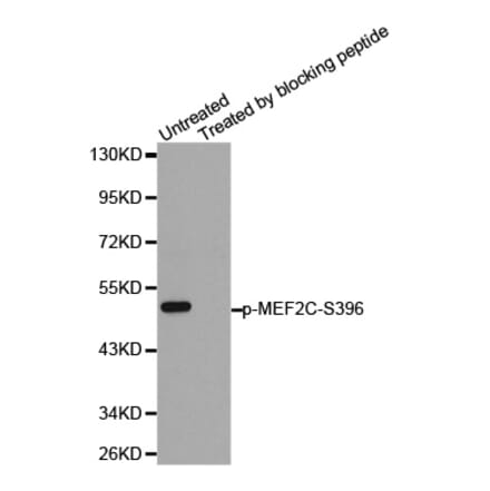 Anti-MEF2C (phospho-S396) Antibody from Bioworld Technology (BS6401) - Antibodies.com