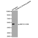 Anti-MEF2C (phospho-S396) Antibody from Bioworld Technology (BS6401) - Antibodies.com