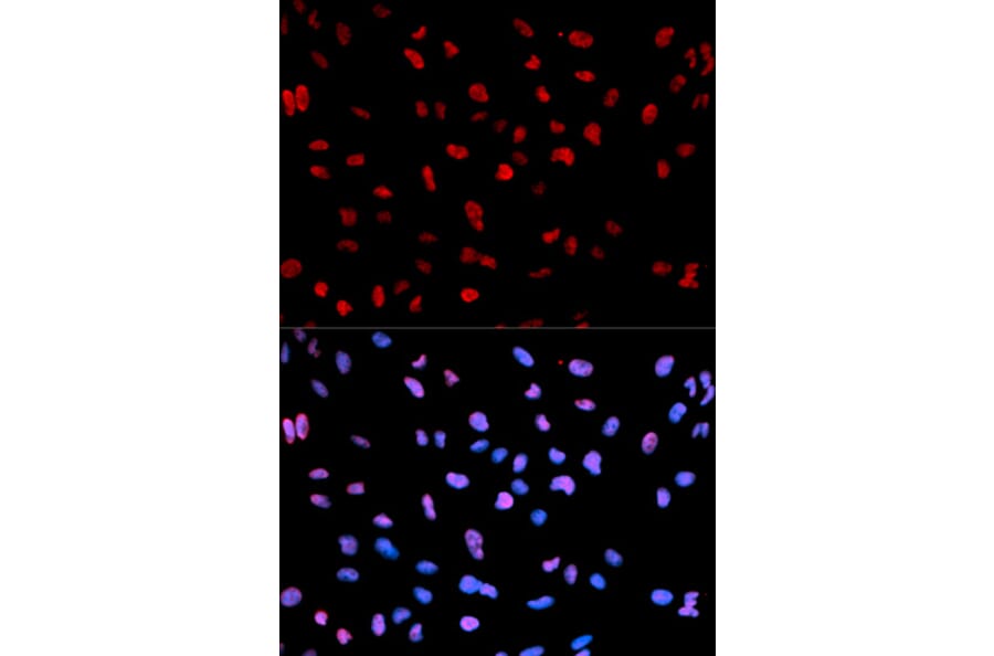 Anti-MEF2C (phospho-S396) Antibody from Bioworld Technology (BS6401) - Antibodies.com