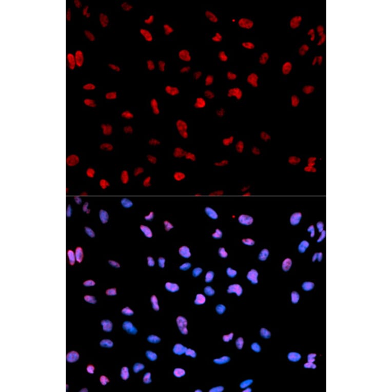 Anti-MEF2C (phospho-S396) Antibody from Bioworld Technology (BS6401) - Antibodies.com