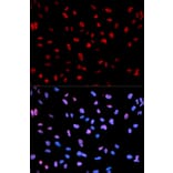 Anti-MEF2C (phospho-S396) Antibody from Bioworld Technology (BS6401) - Antibodies.com