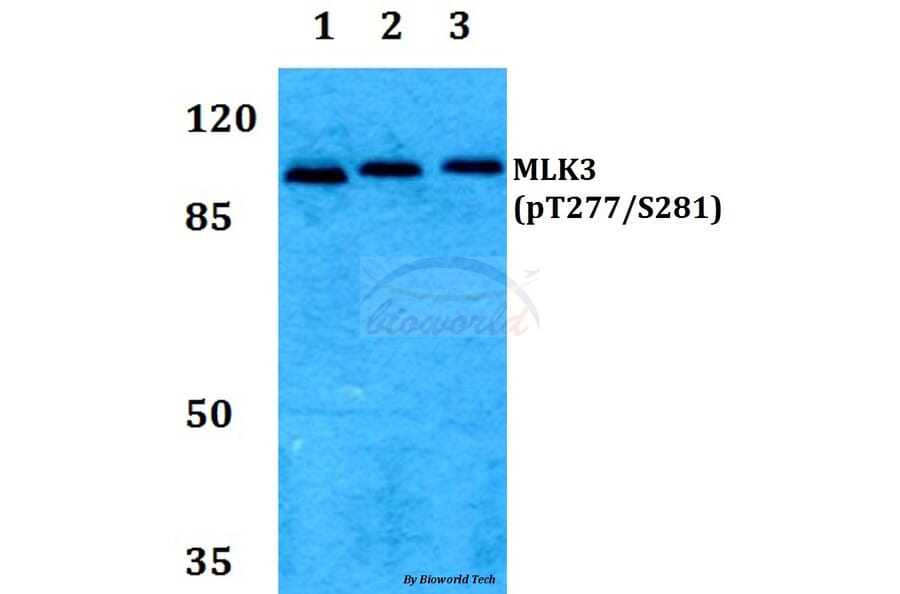 Anti-MLK3 (phospho-T277/S281) Antibody from Bioworld Technology (BS64014) - Antibodies.com