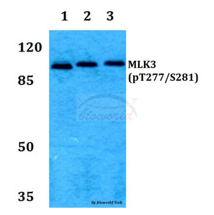 Anti-MLK3 (phospho-T277/S281) Antibody from Bioworld Technology (BS64014) - Antibodies.com