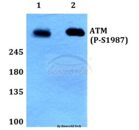 Anti-ATM (phospho-S1987) Antibody from Bioworld Technology (BS64020) - Antibodies.com