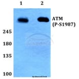 Anti-ATM (phospho-S1987) Antibody from Bioworld Technology (BS64020) - Antibodies.com