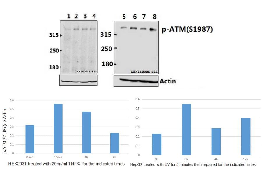 Anti-ATM (phospho-S1987) Antibody from Bioworld Technology (BS64020) - Antibodies.com